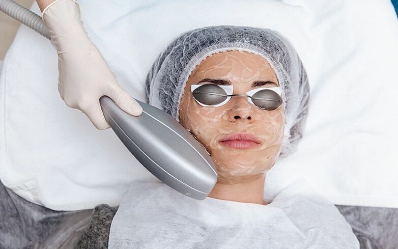 skin regeneration procedure
