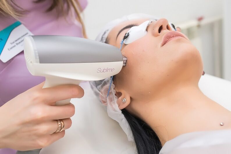 performing a laser skin rejuvenation procedure