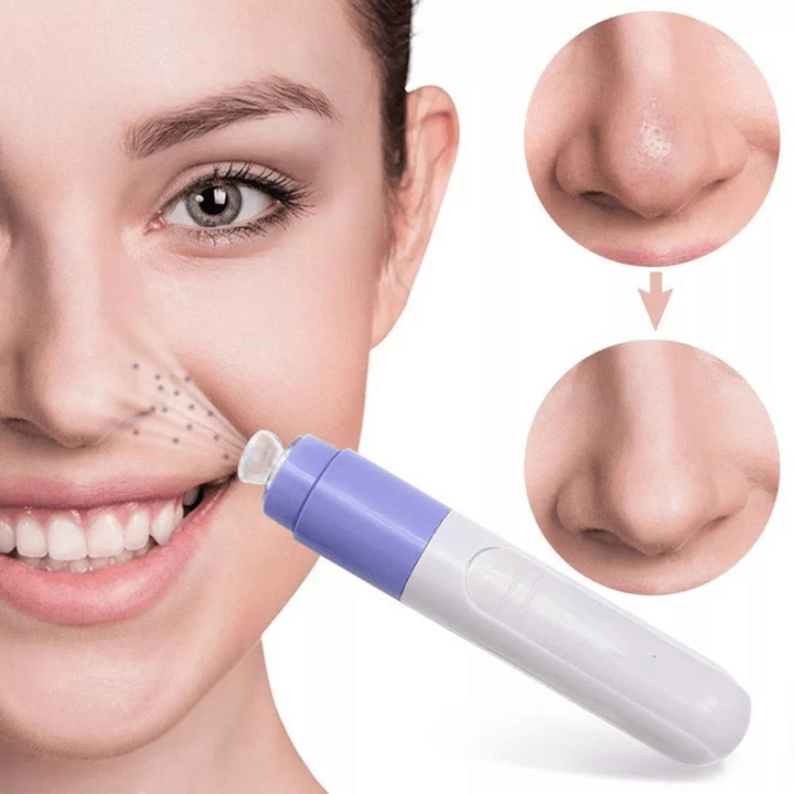 vacuum device for facial rejuvenation